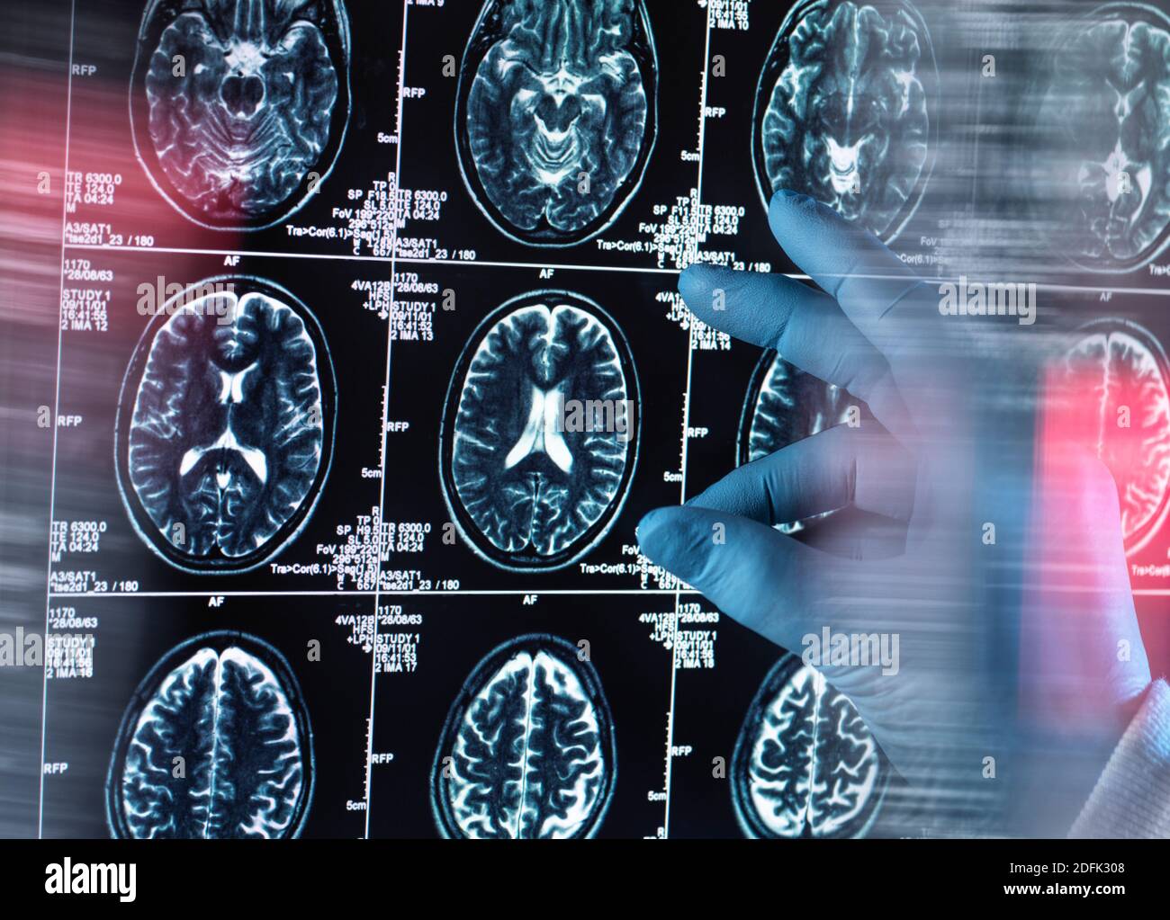 Neurological Examination Hi Res Stock Photography And Images Alamy