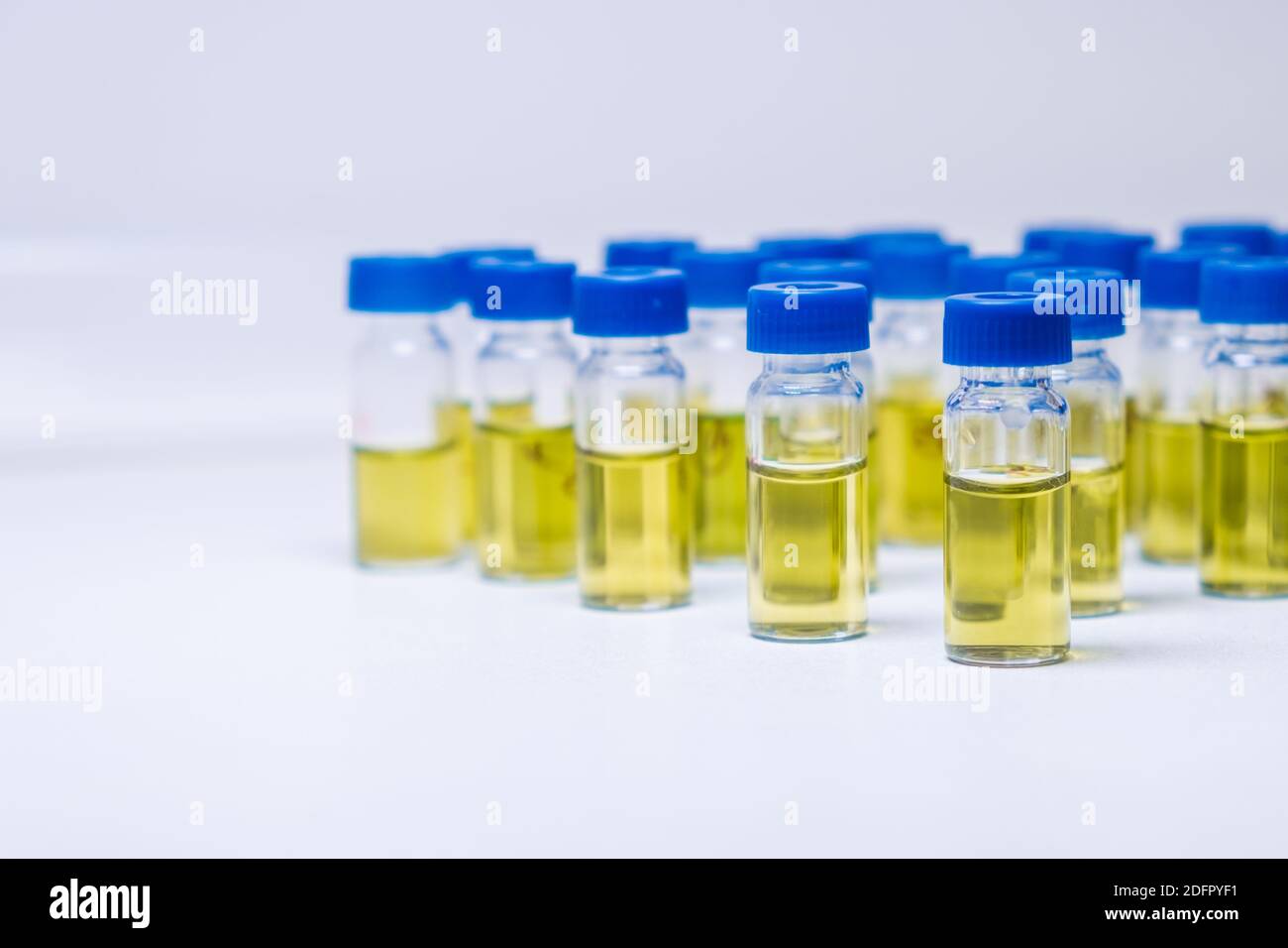 Test tubes with urine sample for HPLC analysis in the laboratory Stock ...