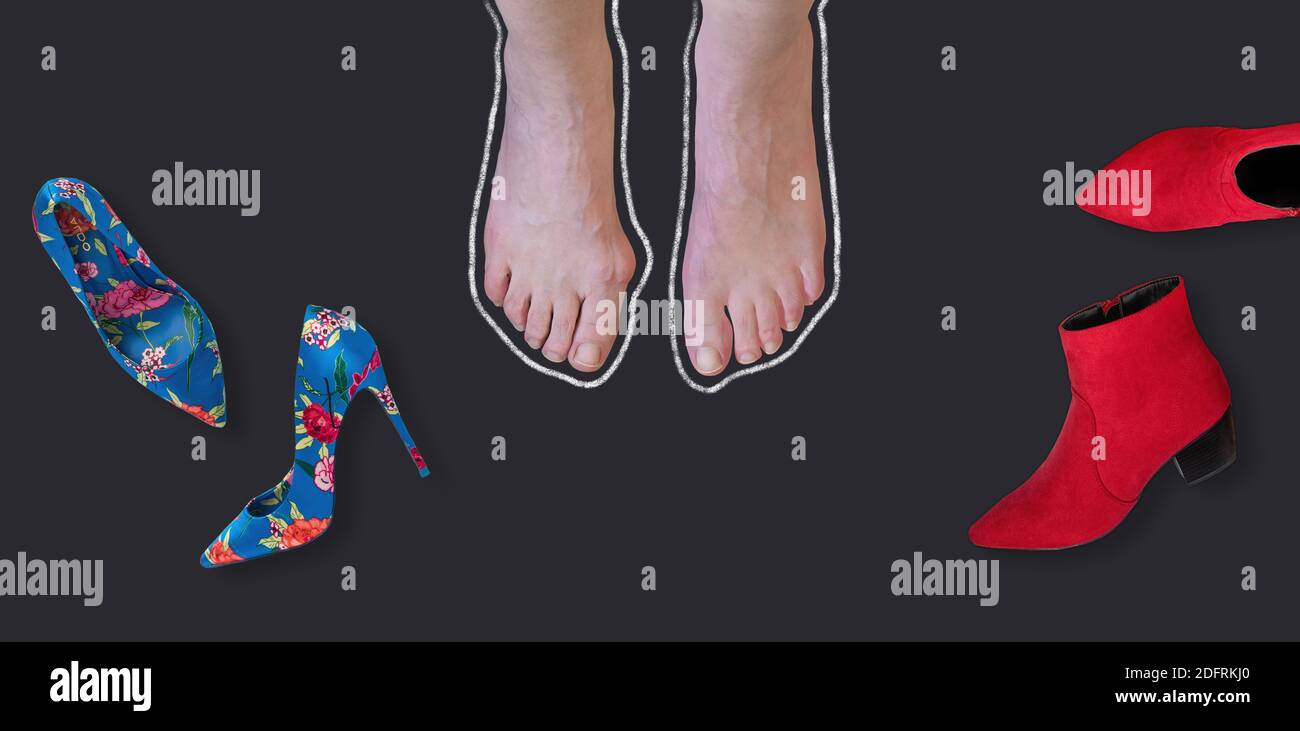 Chalk outline of hallux valgus, bunion in woman foot and high heels on black background. Overhead shot with copy space. Stock Photo