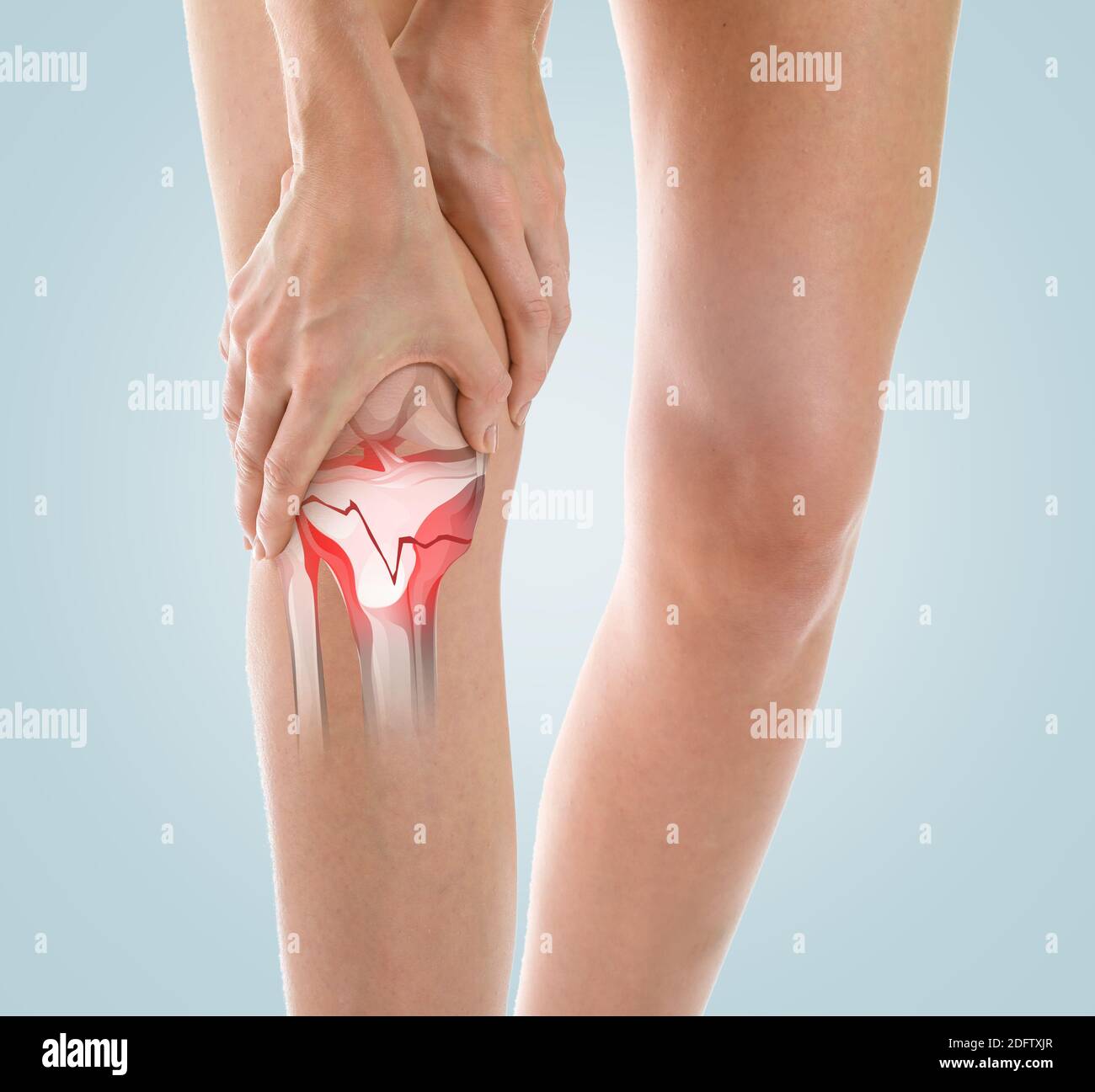 Young Woman With Broken Leg Suffering From Pain In Office Stock Photo Alamy