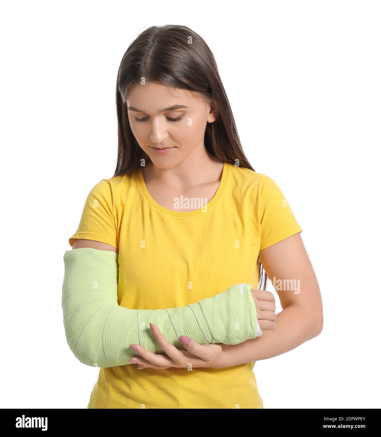 Young woman with broken arm on white background Stock Photo Alamy