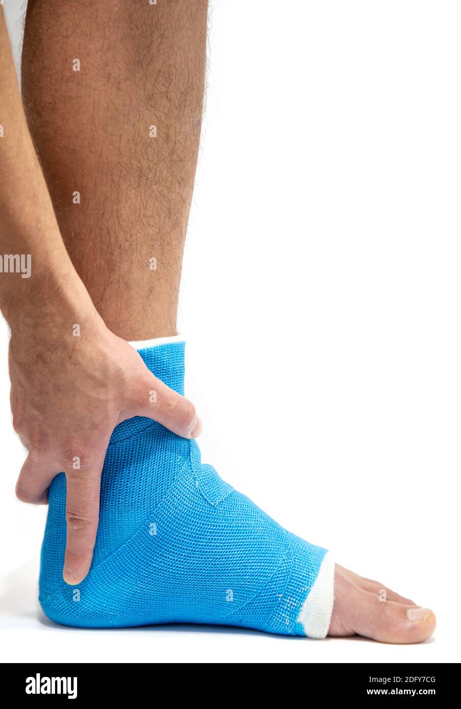Blue splint ankle. Bandaged leg cast on male patient on white
