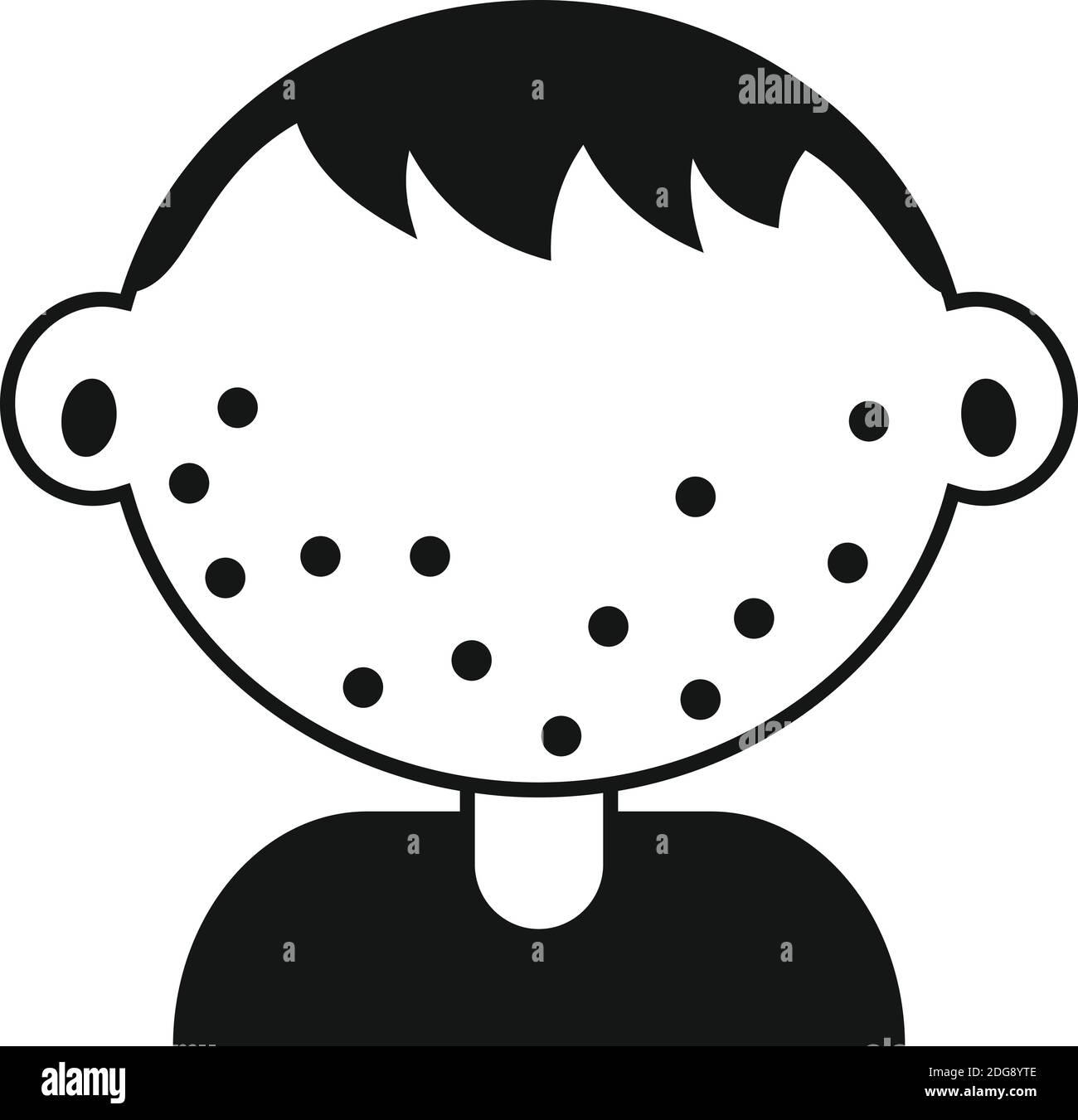 Chicken pox kid boy icon, simple style Stock Vector Image & Art - Alamy