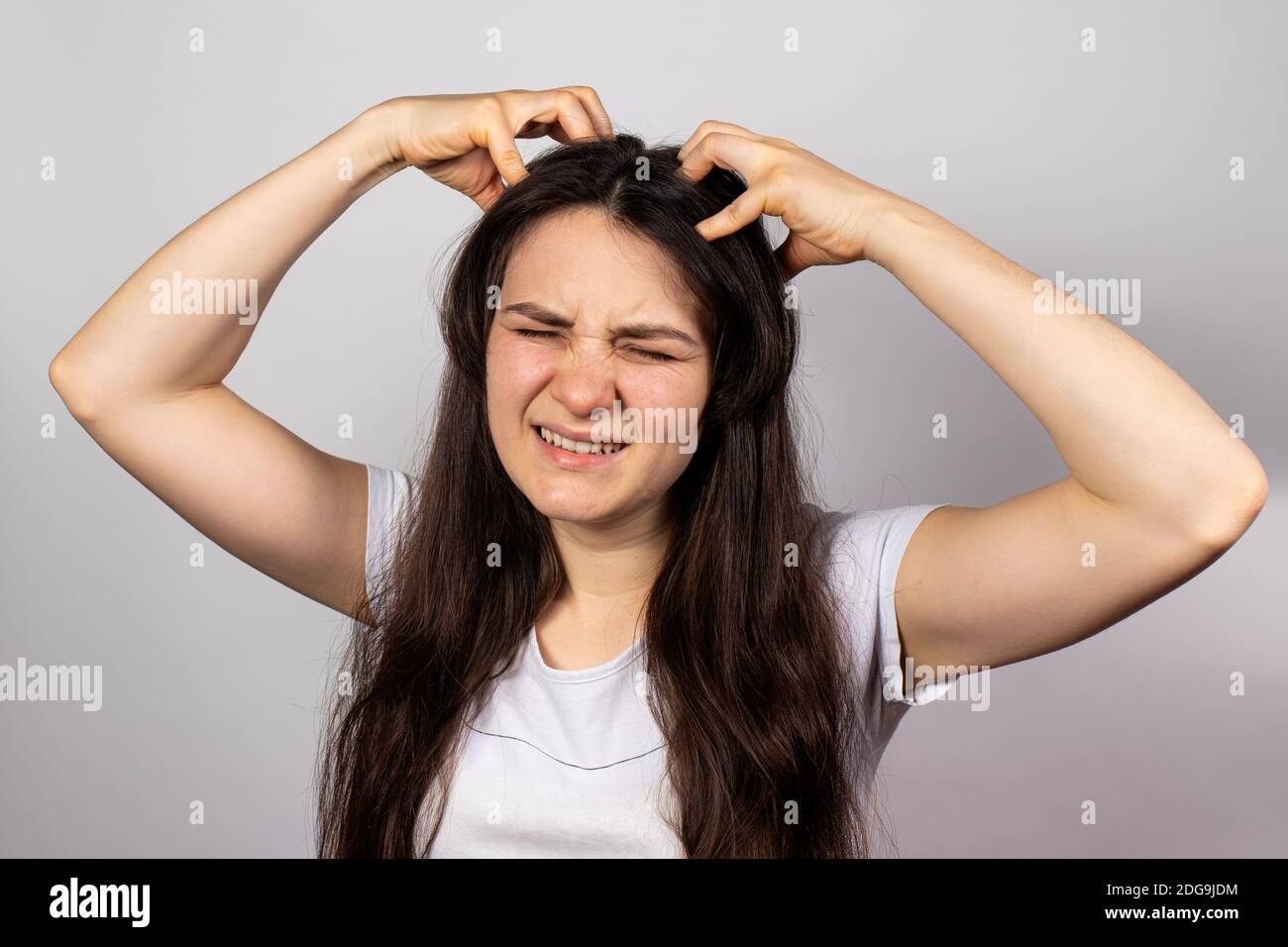 The girl scratches her head with both hands, itchy scalp due to infectious contagious disease lice. Pediculosis in humans Stock Photo