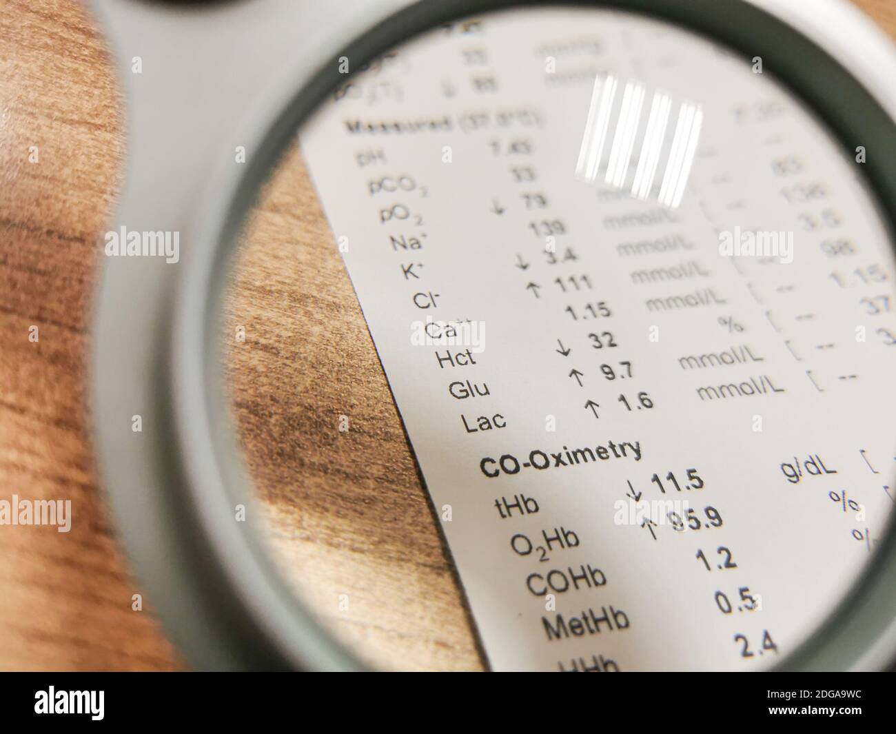 Blood Gas Analysis High Resolution Stock Photography and Images Alamy