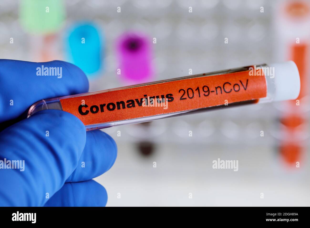 2019-nCoV Middle East respiratory syndrome coronavirus with blood sample Stock Photo