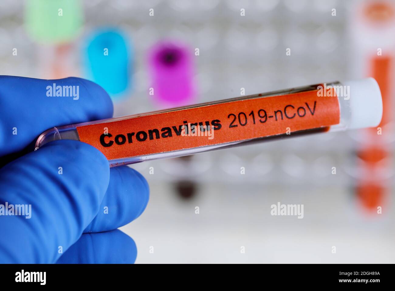 2019-nCoV Middle East respiratory syndrome coronavirus with blood ...