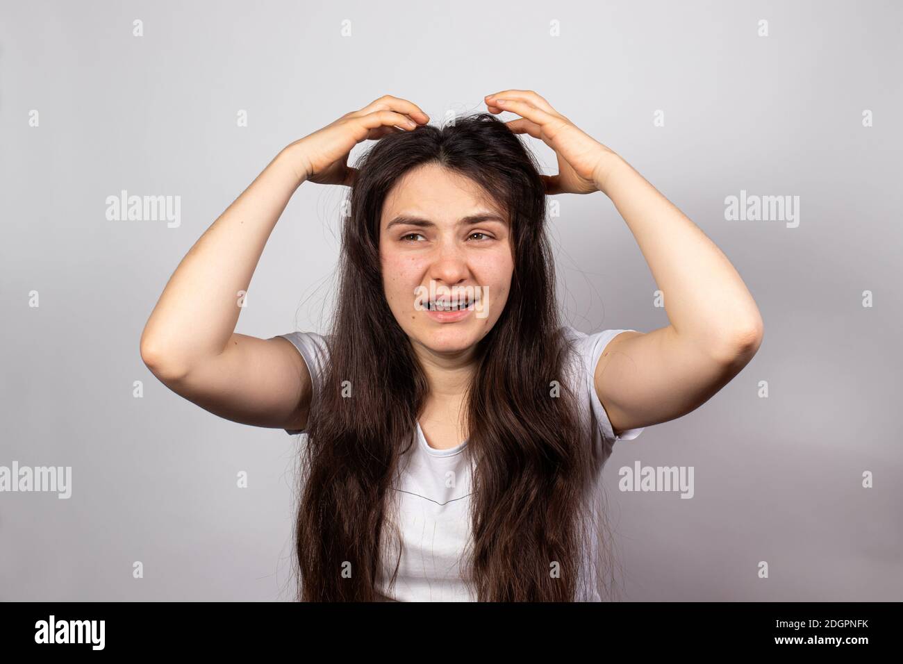 The girl scratches her head and screams. Lice in hair, pediculosis infectious parasitic