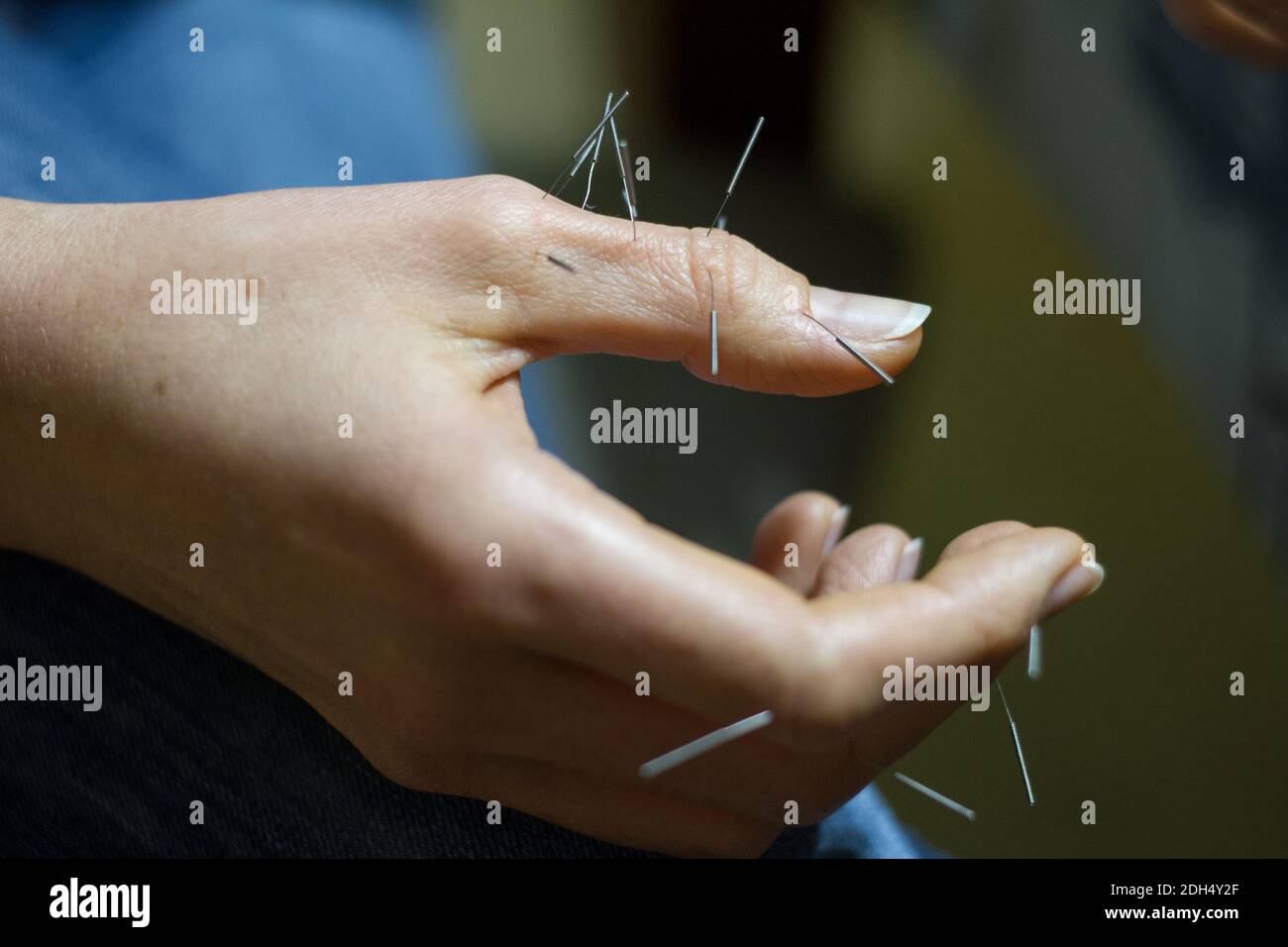 Close-up of female hand with acupuncture needles, alternative treatments, selective focus Stock Photo