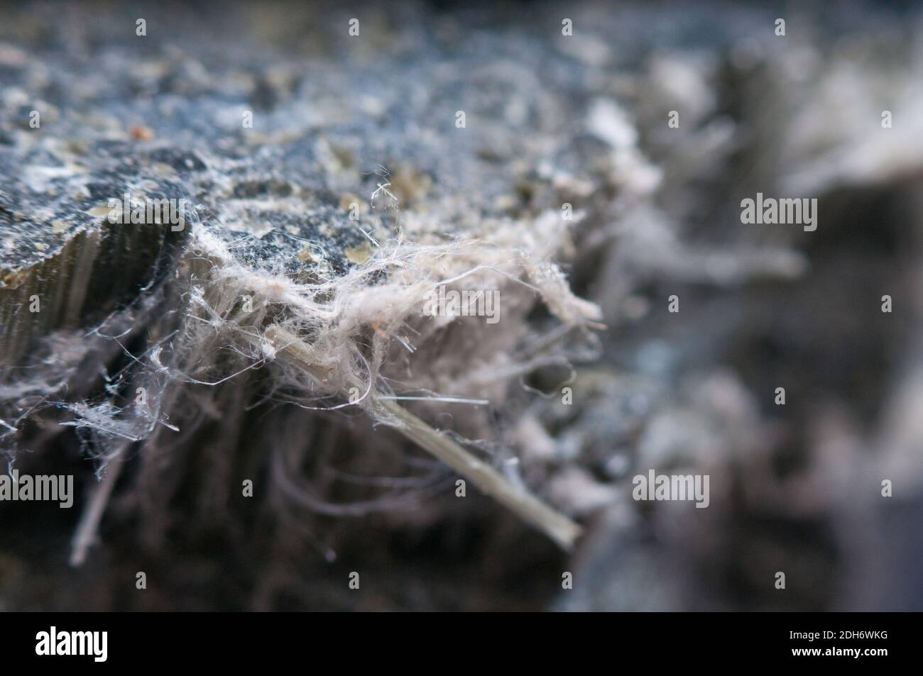 asbestos chrysotile fibers that cause lung disease, COPD, lung cancer