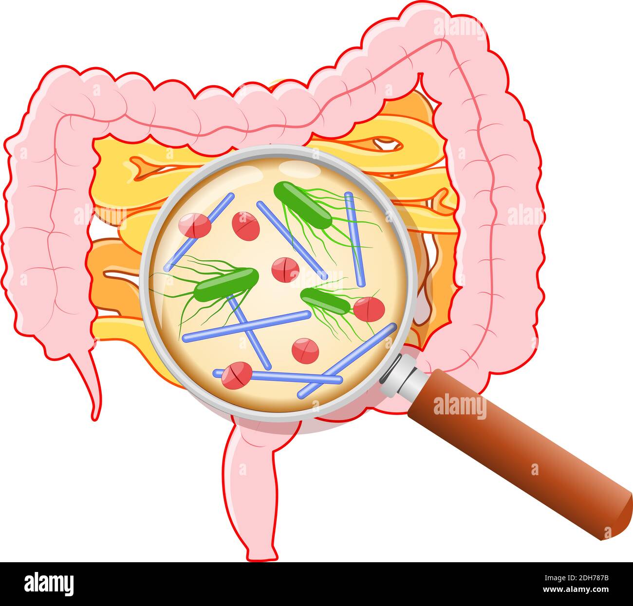Gut flora. Human small intestine, colon and magnifying glass. Close-up of bad bad bacteria: Clostridium perfringens, Enterococcus faecalis Stock Vector