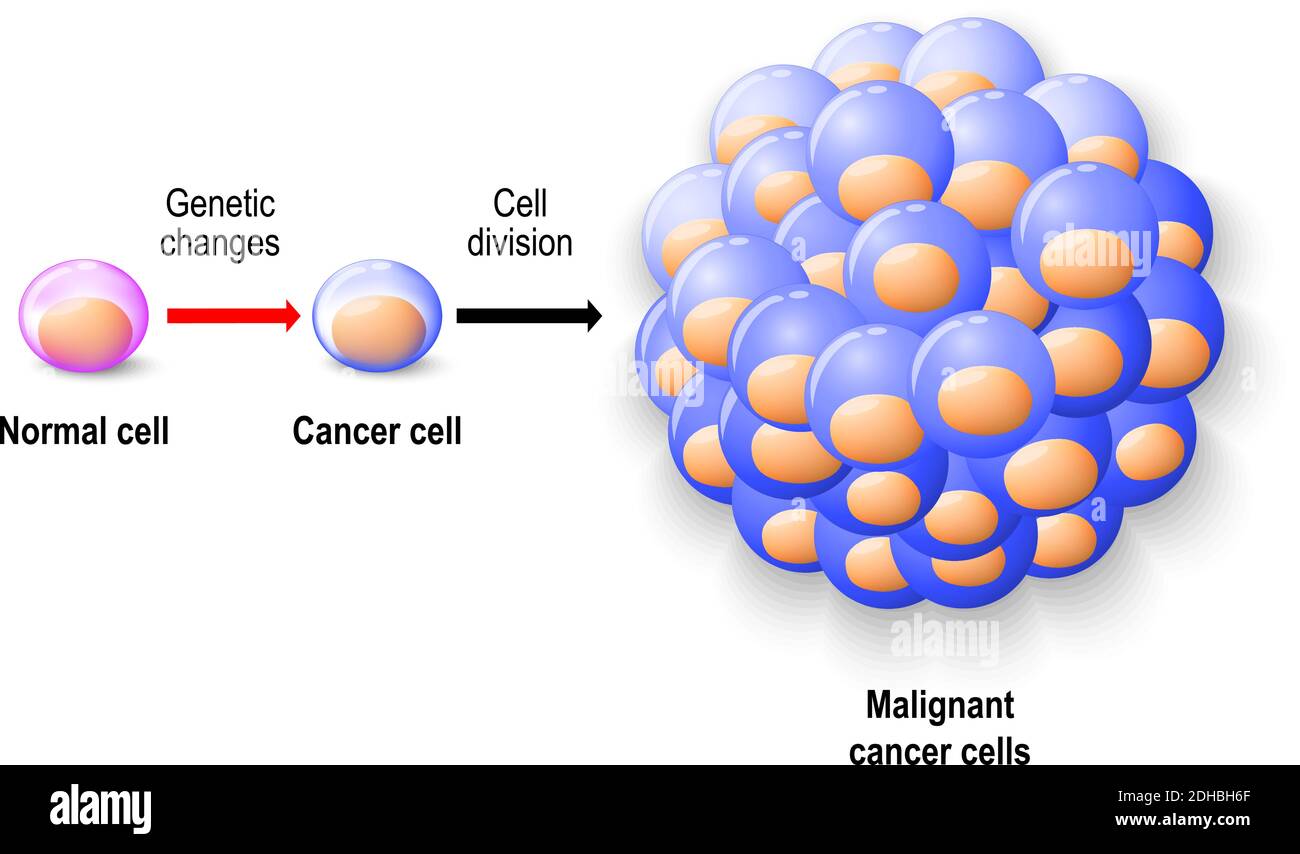 Normal human cell reborn to cancer cells, and growing to malignant tumor. Human anatomy Stock Vector