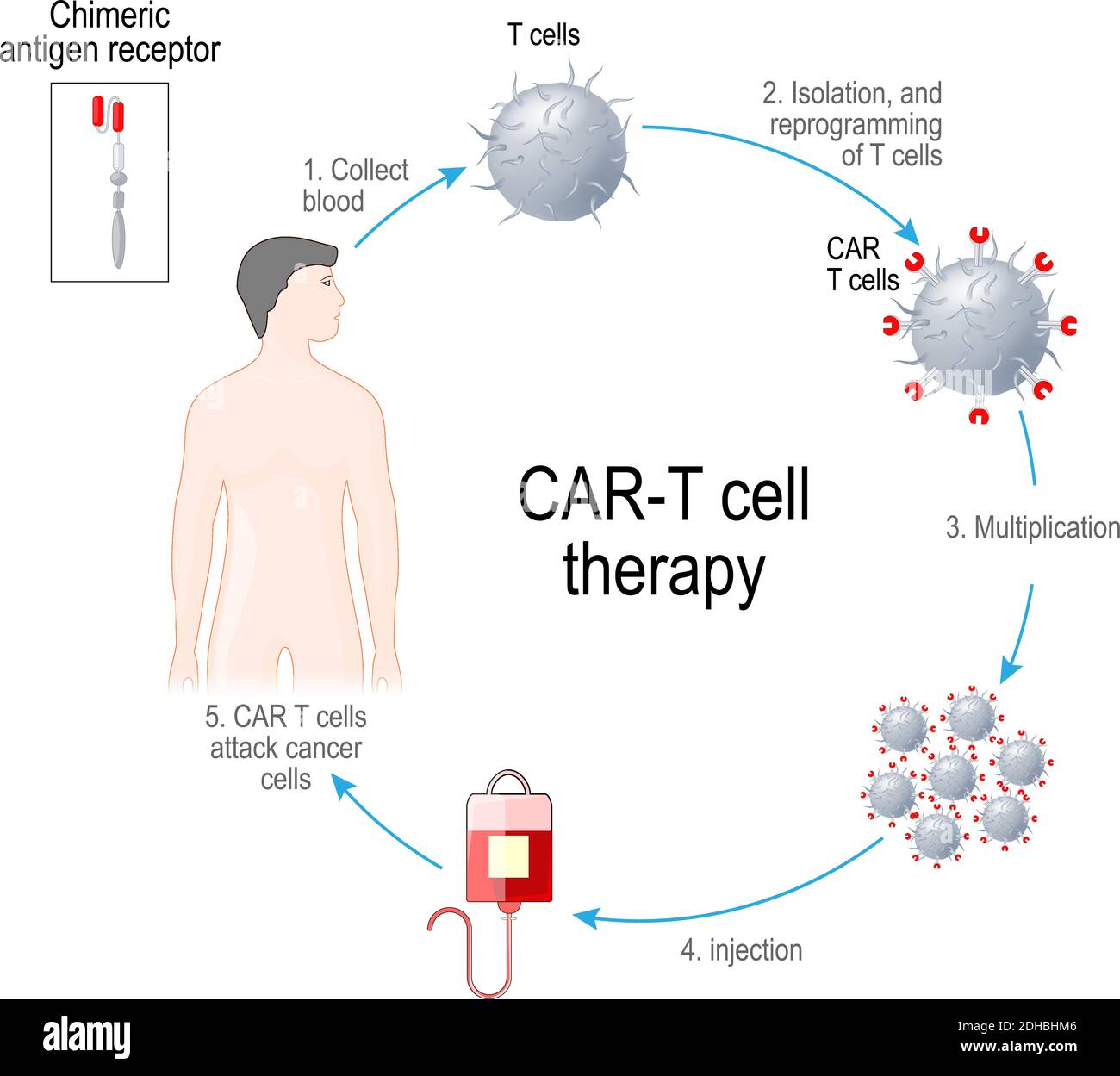 CAR T-cell therapy. Artificial leukocyte receptors are proteins that have been engineered for cancer immunotherapy (killing of tumor cells). genetical Stock Vector