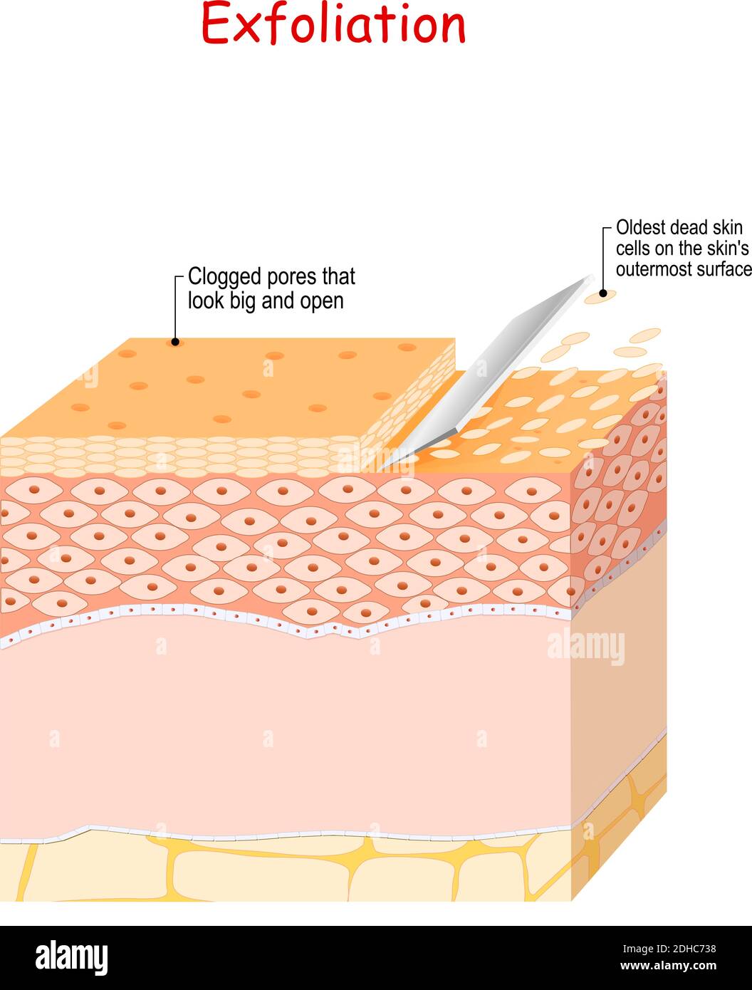 Exfoliation. Peeling or Physically scrubbing. Skin Care. Close up Of Peeling procedure. Cosmetology. Exfoliation is removal of the old dead cells Stock Vector