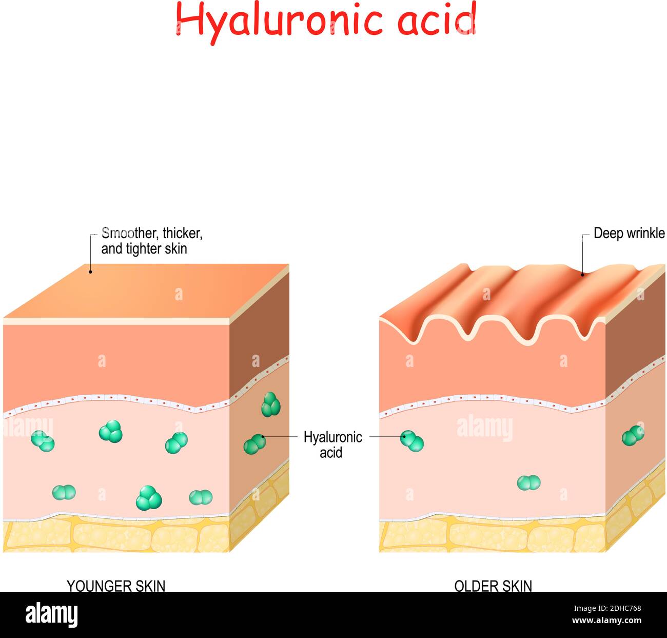 Hyaluronic acid in younger and older skin. skin-care products and rejuvenation with help of hyaluronic acid Stock Vector