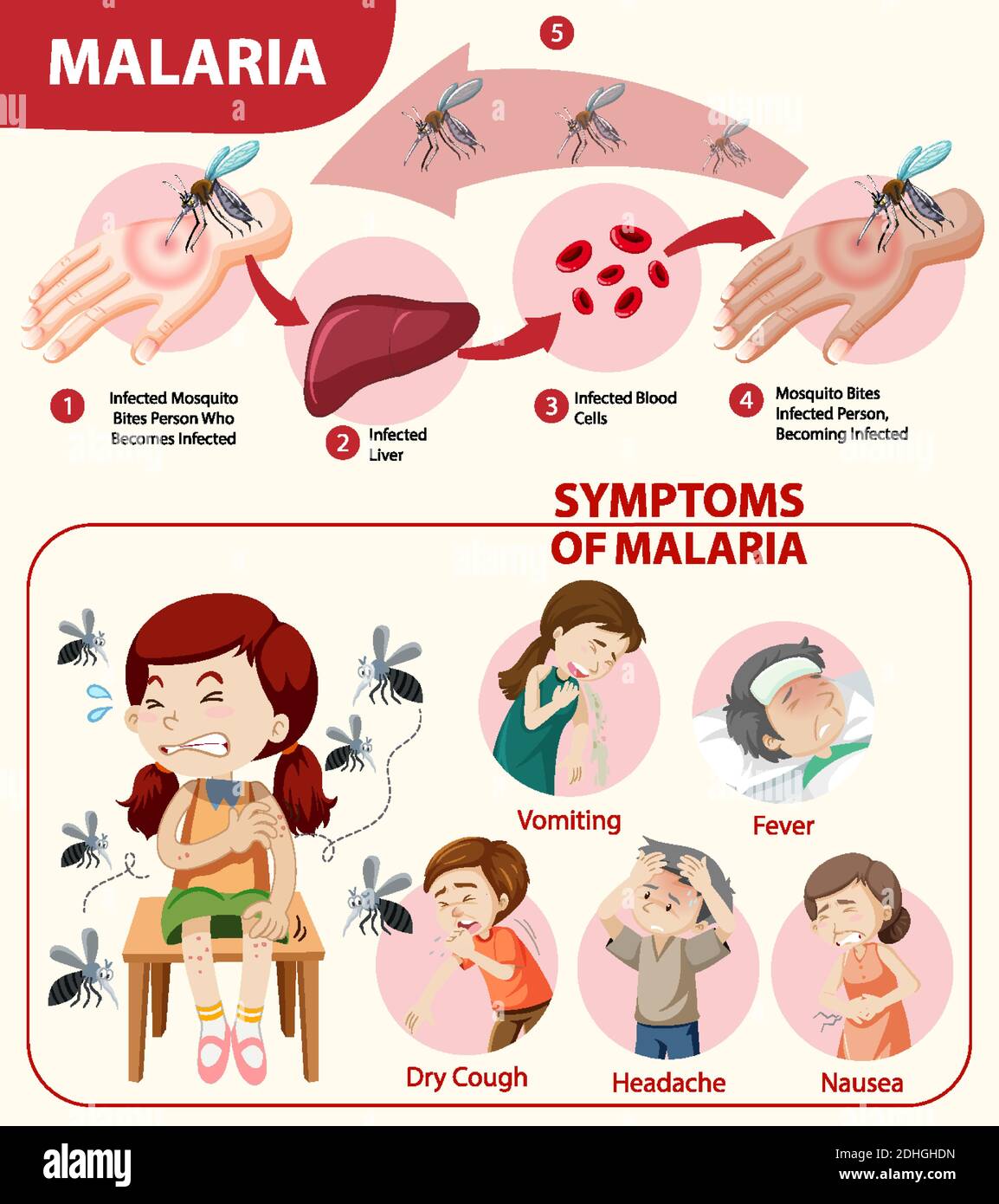 Malaria symptom information infographic illustration Stock Vector Image Malaria symptom information infographic illustration Stock Vector Image