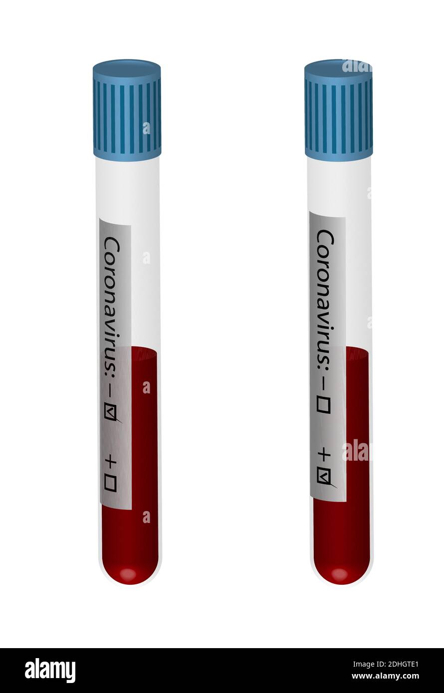 realistic test tubes with blood samples for coronavirus analyzes. Positive and negative result. Isolated vector on white background Stock Vector