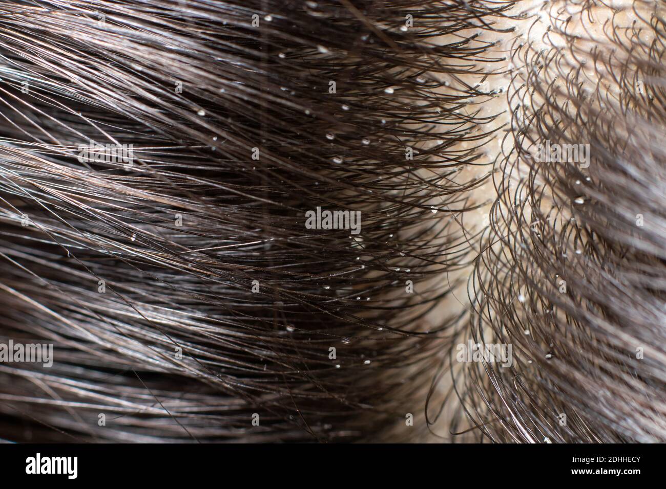 Macro photo dander on dark hair. The problem of dried scalp
