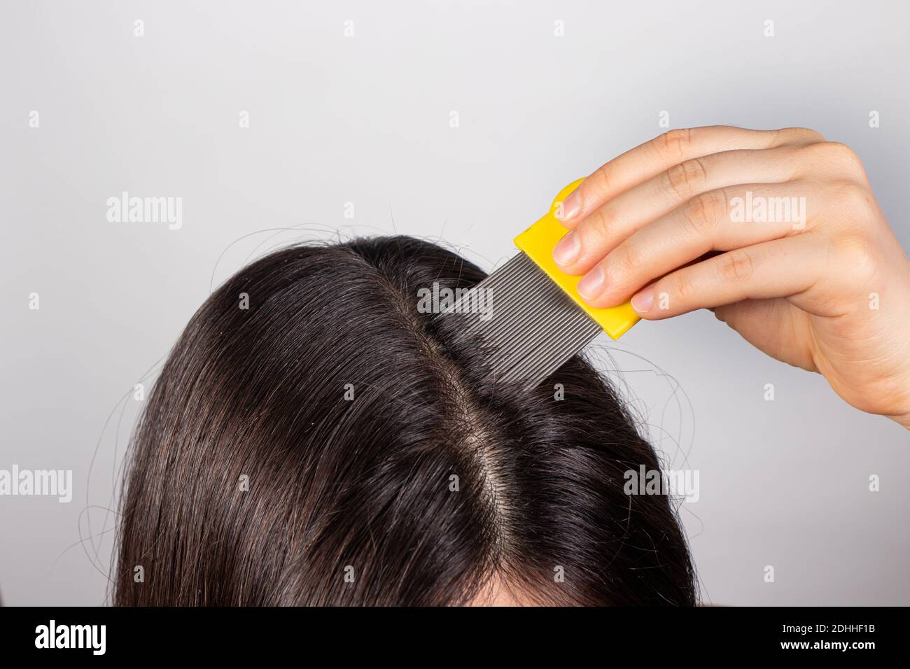 A brunette woman with pediculosis cleans her hair from lice and nits with a comb with small prongs. A lice comb Stock Photo
