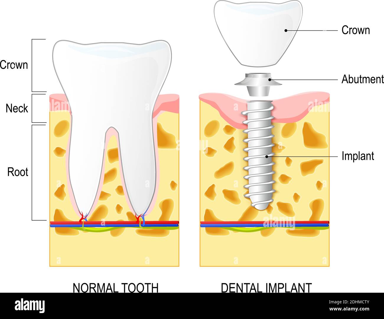 Lower denture Stock Vector Images Alamy