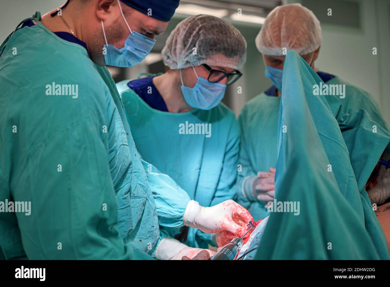 Physicians in Surgery looking down at patient Stock Photo - Alamy