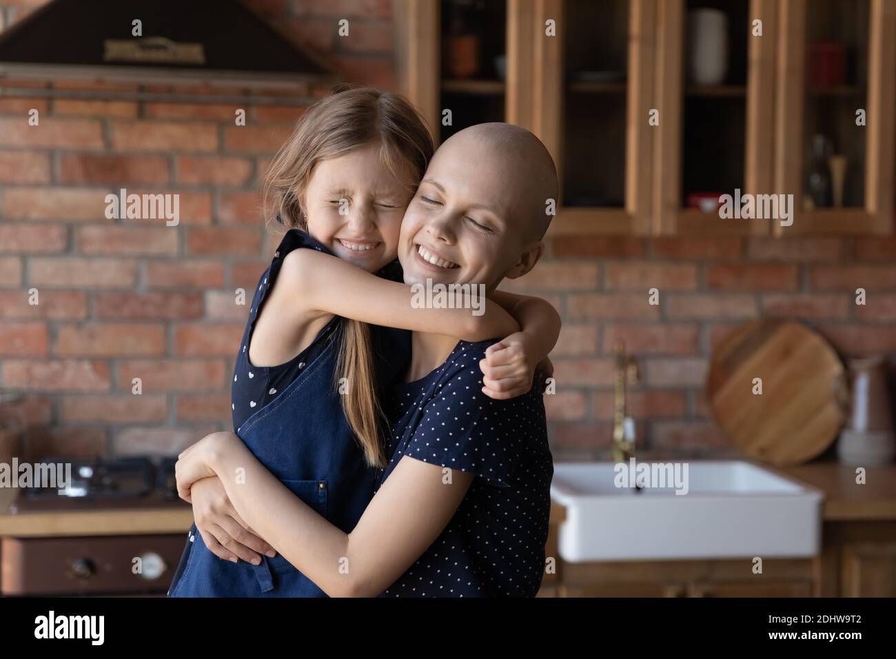 Close up happy sick hairless mother and little daughter cuddling Stock Photo
