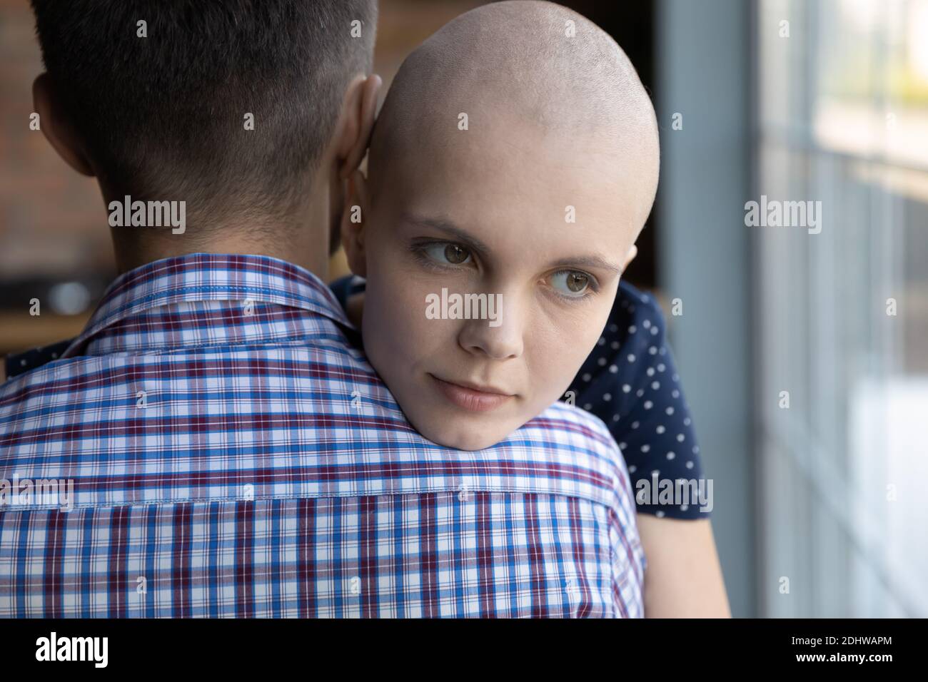 Close up loving husband hugging sick hairless wife, showing care Stock Photo