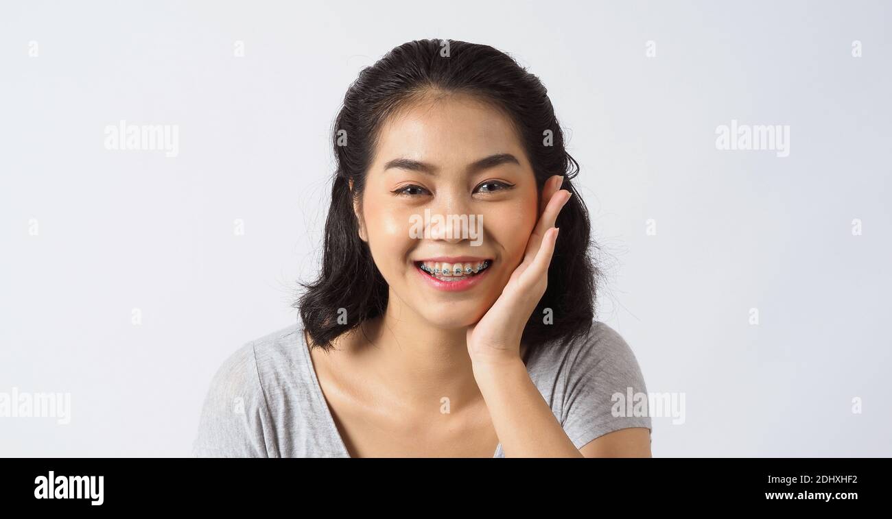 Dental brace beautiful girl smiling looking on a camera. white teeth with blue braces. Dental