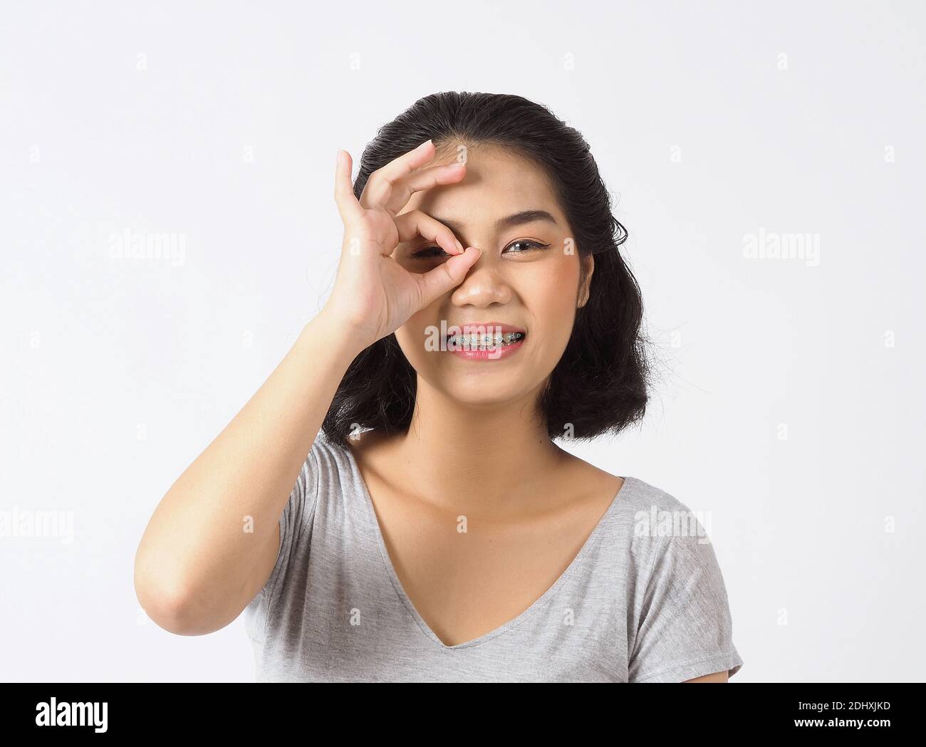 Dental brace teen girl smiling looking on a camera. white teeth with blue  braces. Dental care. Asian woman smile with orthodontic accessories.  Cosmeti Stock Photo - Alamy