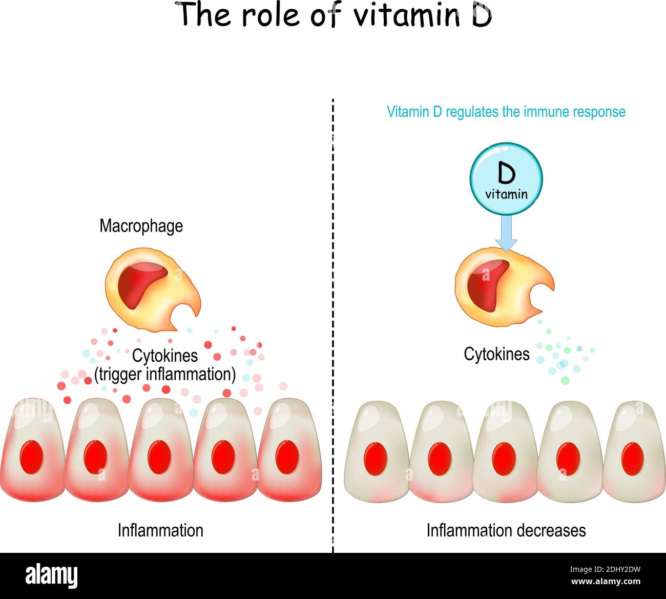 Vitamin D, immune system and COVID-19. Vitamin D regulates the immune response. cytokine storm. COVID-19 complications. Difference and comparison Stock Vector