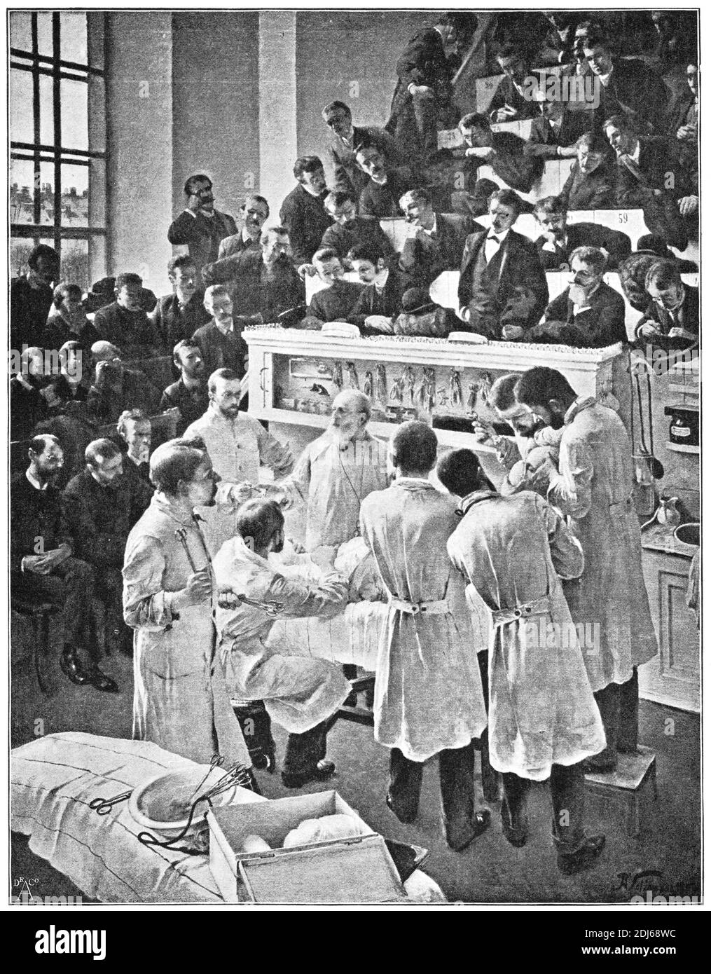The German surgeon Theodor Billroth operating in the auditorium of Vienna General Hospital (Allgemeine Krankenhaus). Illustration of the 19th century. Germany. White background. Stock Photo