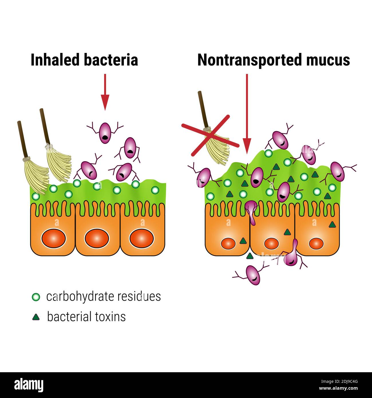 Bacterial interaction with respiratory mucus. Mucociliary transport. Respiratory pathogens release factors. Medical vector illustration Stock Photo