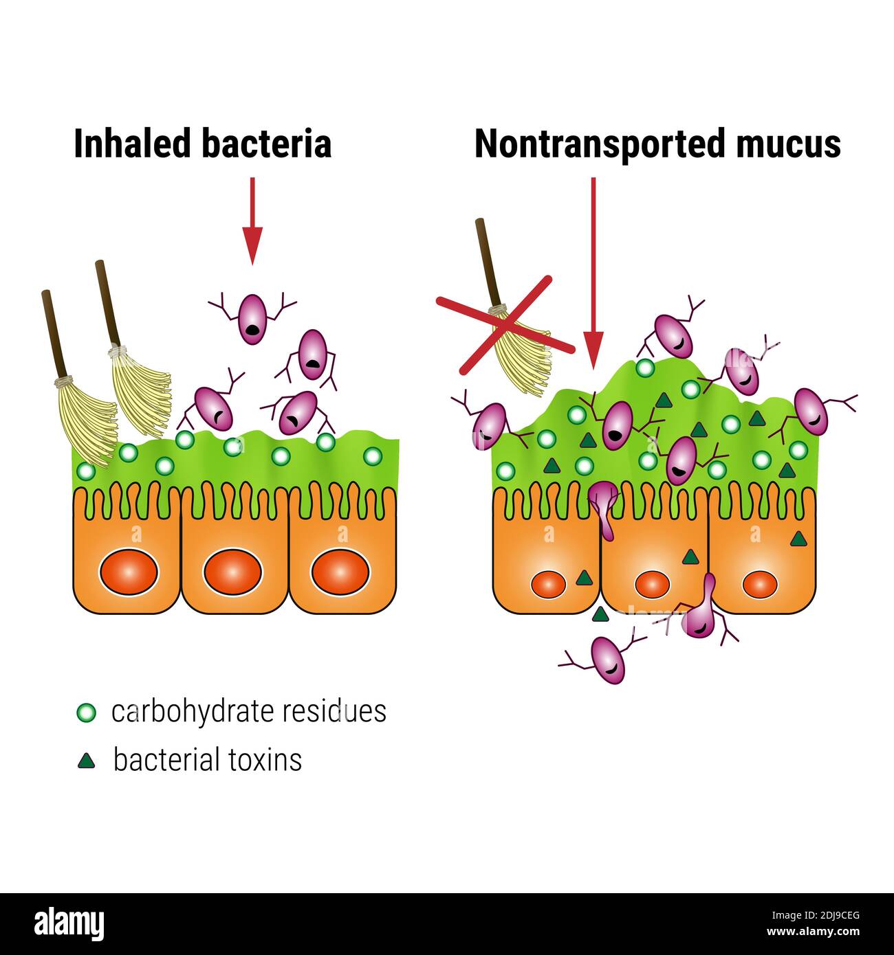 Bacterial interaction with respiratory mucus. Mucociliary transport. Respiratory pathogens release factors. Medical vector illustration Stock Vector