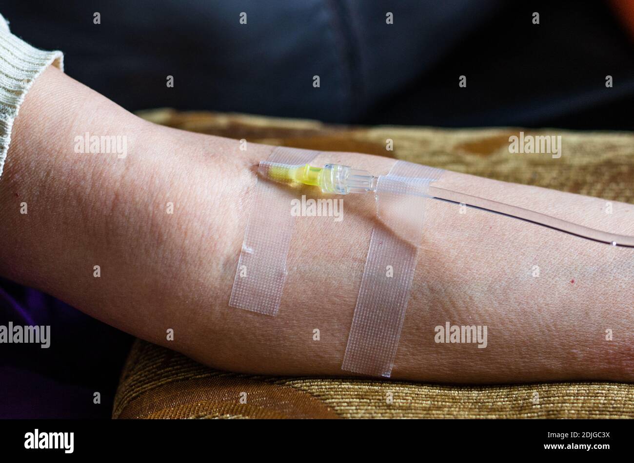 Intravenous vitamin c therapy hires stock photography and images Alamy