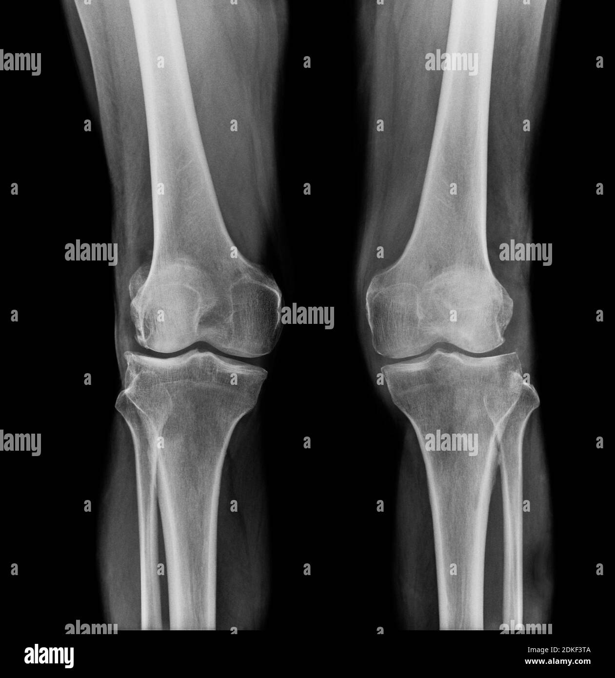 Full body x ray hires stock photography and images Alamy