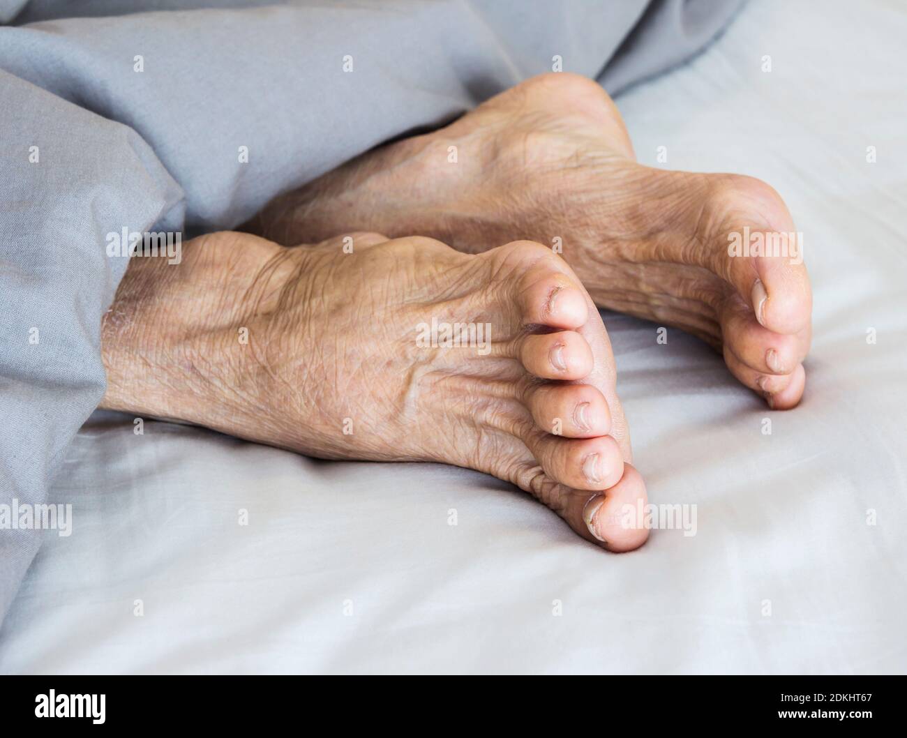 Ножки пожилых