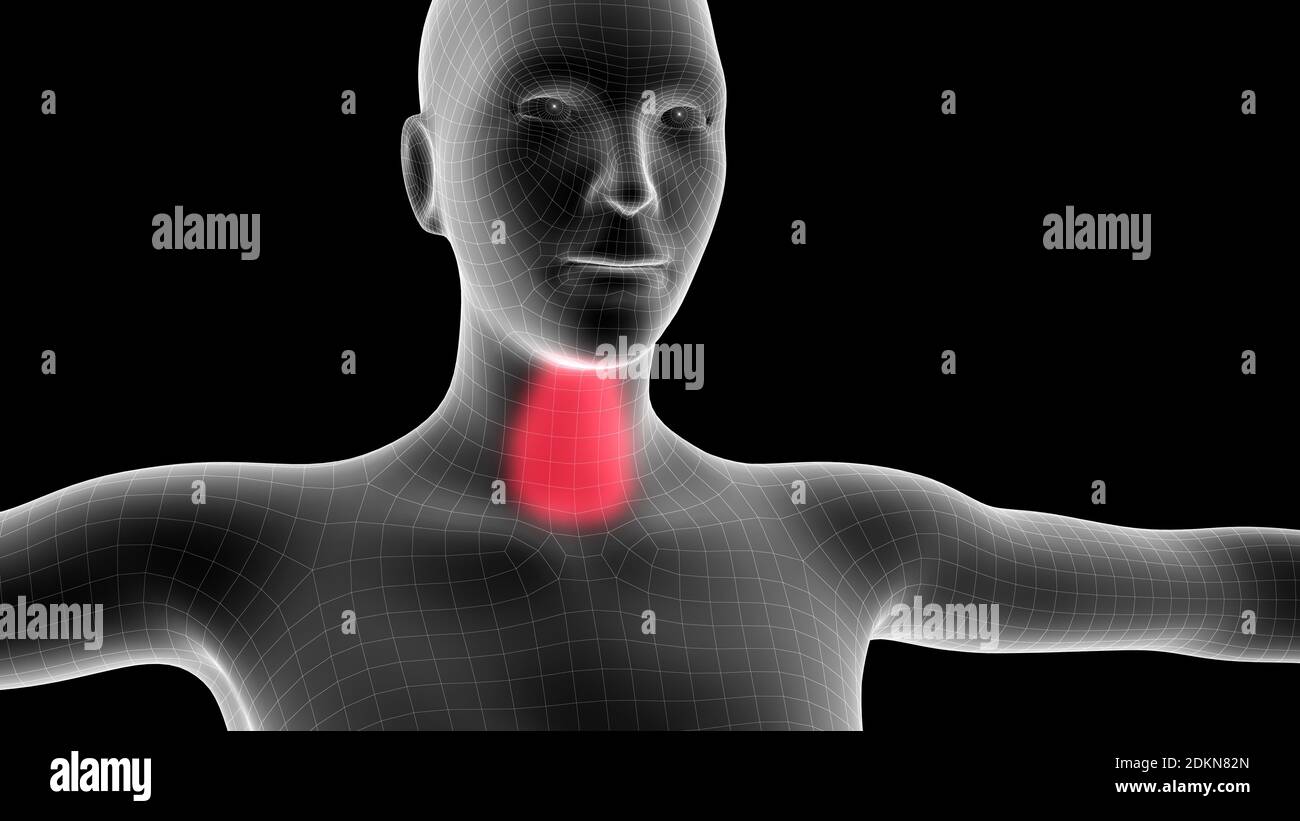 3d Illustration Of Headache Human X Ray Medical Concept Stock Photo Alamy