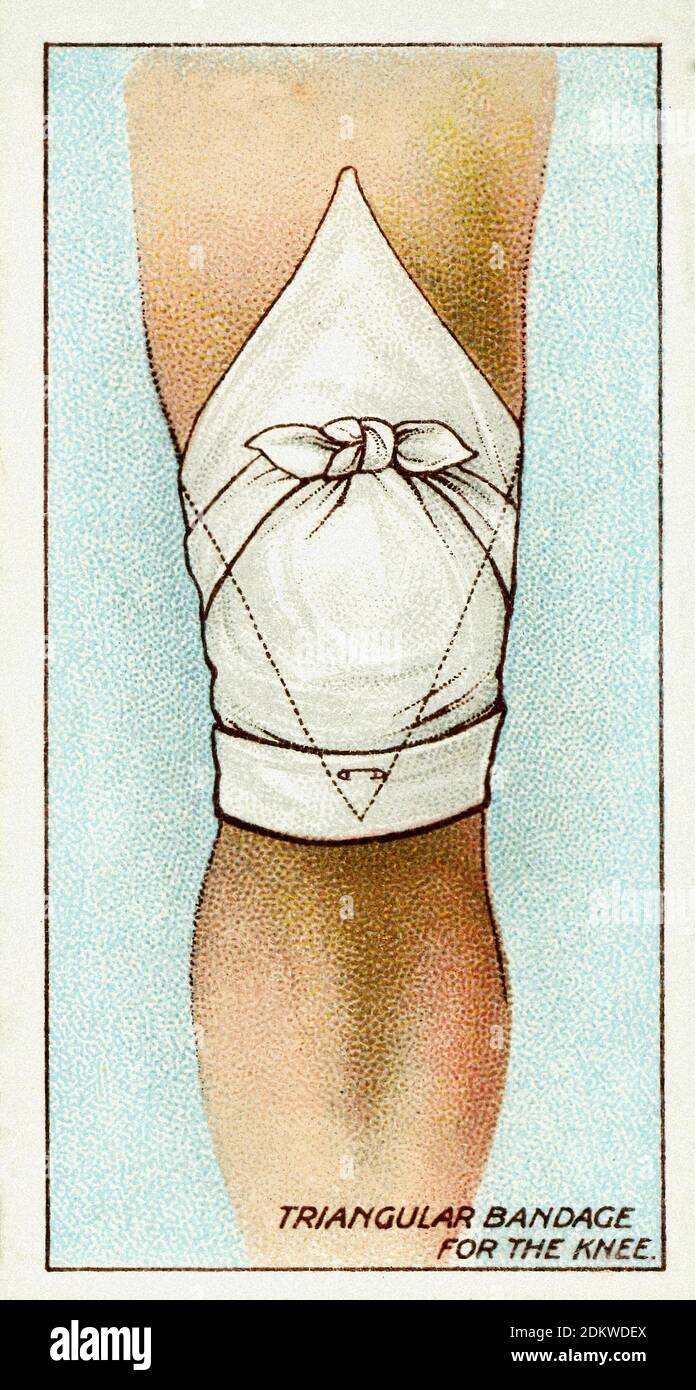 Antique cigarettes cards. Wills's Cigarettes (series First Aid ). Knee Bandage, England. 1913