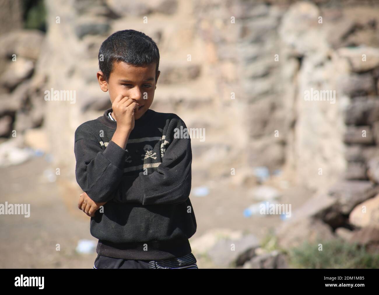 Taiz   Yemen   24 Mar 2018 :Yemeni child sad because of the loss of his eye Stock Photo