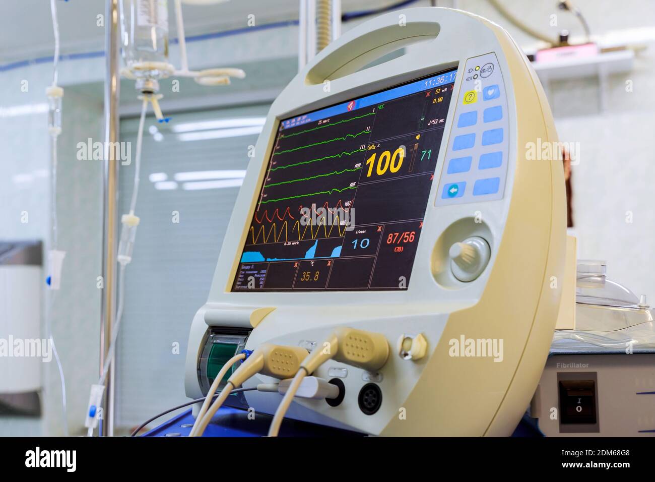Ventilation equipment close up image monitor of computer device in intensive care operating room Stock Photo
