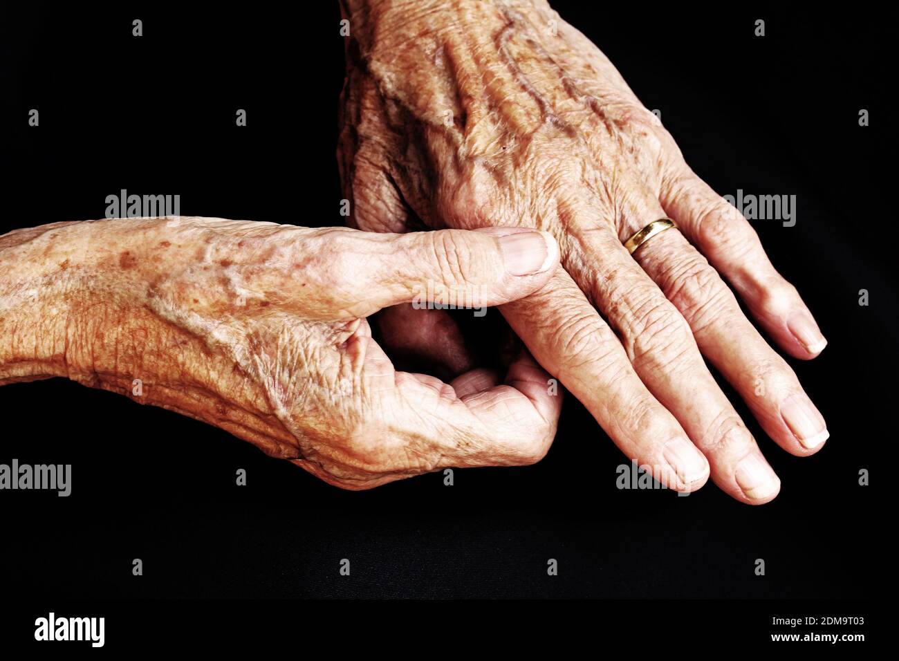 An old woman has pain in her hands Stock Photo