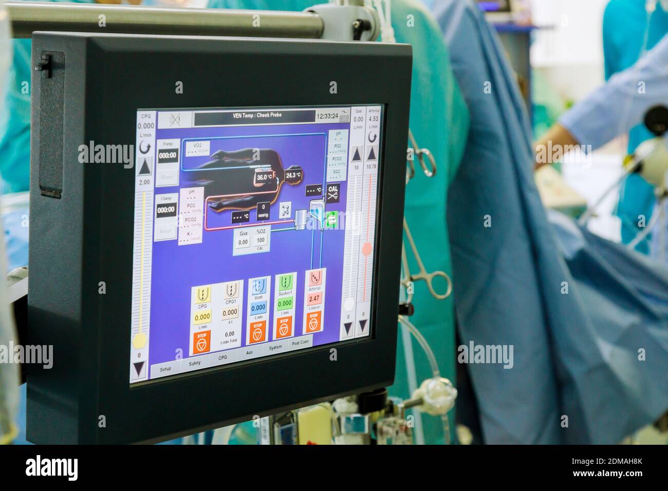 Cardiopulmonary bypass monitor, artificial blood circulation apparatus on the intensive care unit Stock Photo