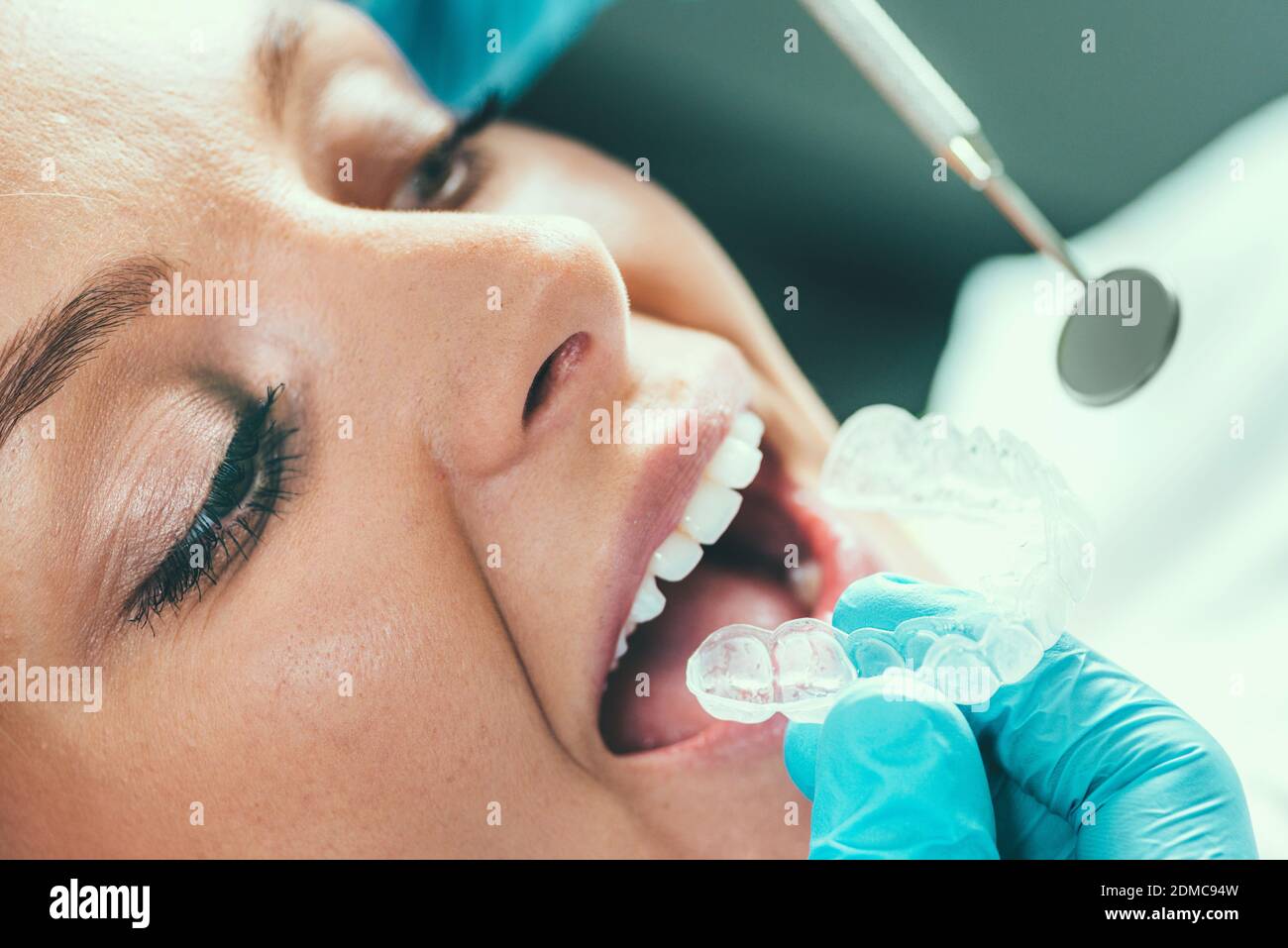 Teeth Whitening Procedure Stock Photo Alamy