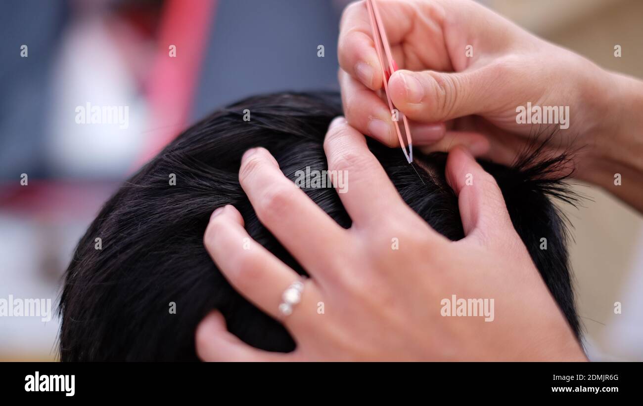Close-up Of Woman Plucking White Hair From Man Head Stock Photo - Alamy Close-up Of Woman Plucking White Hair From Man Head Stock Photo - Alamy