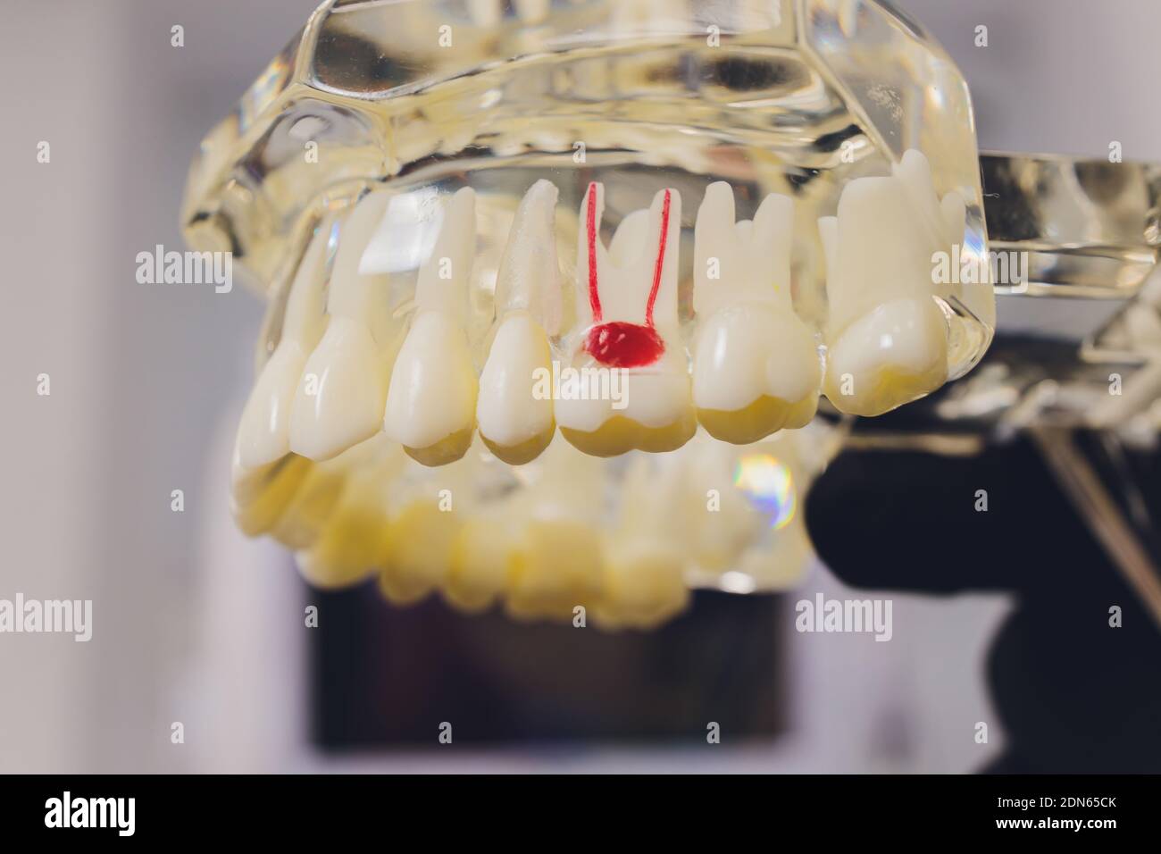 Capillary Root Orthodontist holds jaw in his hands for training. Package with ...