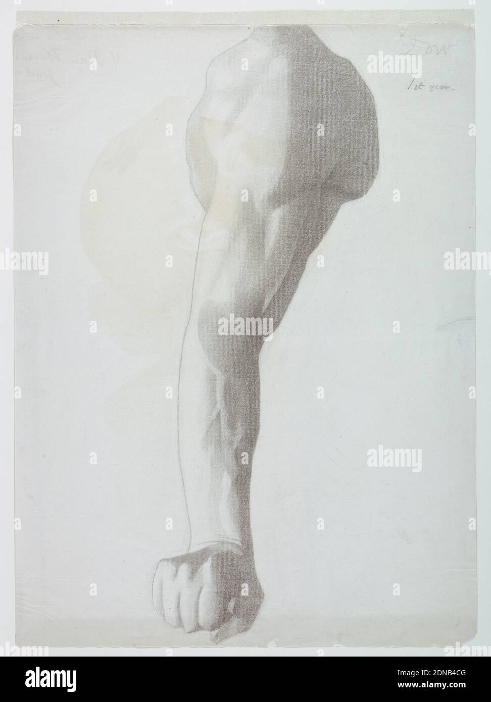 Arm cast and drawing hires stock photography and images Alamy