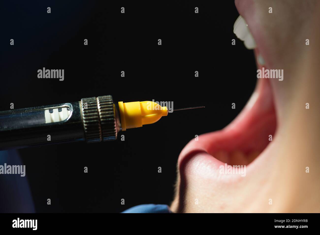 Novocaine High Resolution Stock Photography and Images Alamy