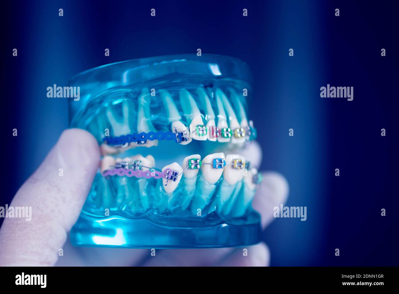 Dental teeth aligner bracket teaching student model showing gums and