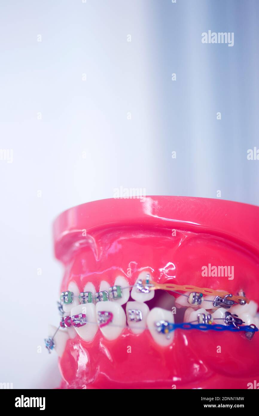 Dental teeth aligner bracket teaching student model showing gums and