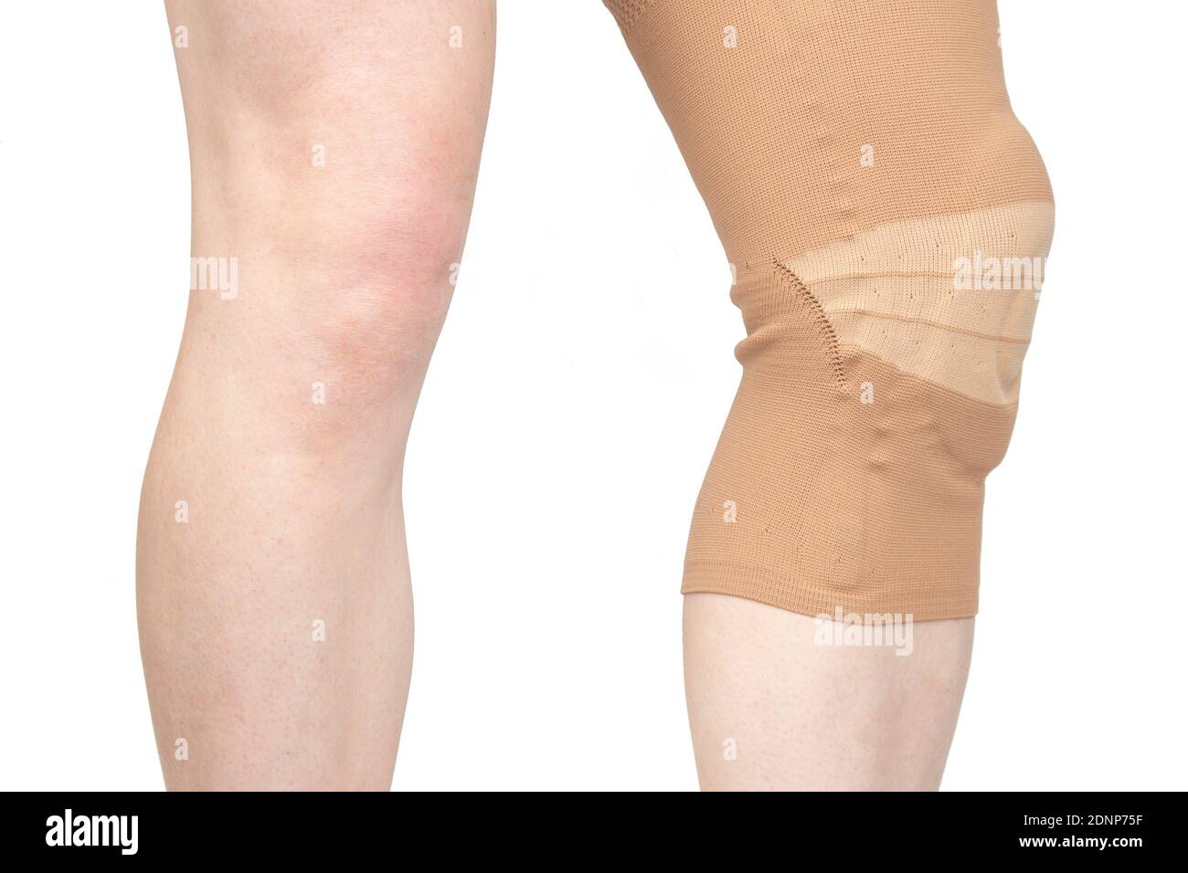 bandage for fixing the injured knee of the leg. medicine and sports